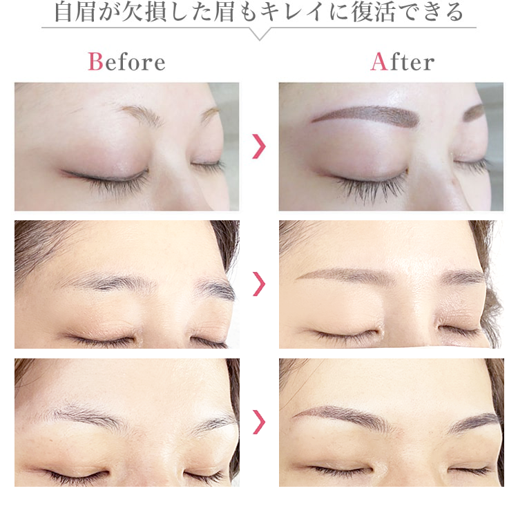 自眉が欠損した眉もキレイに復活できる