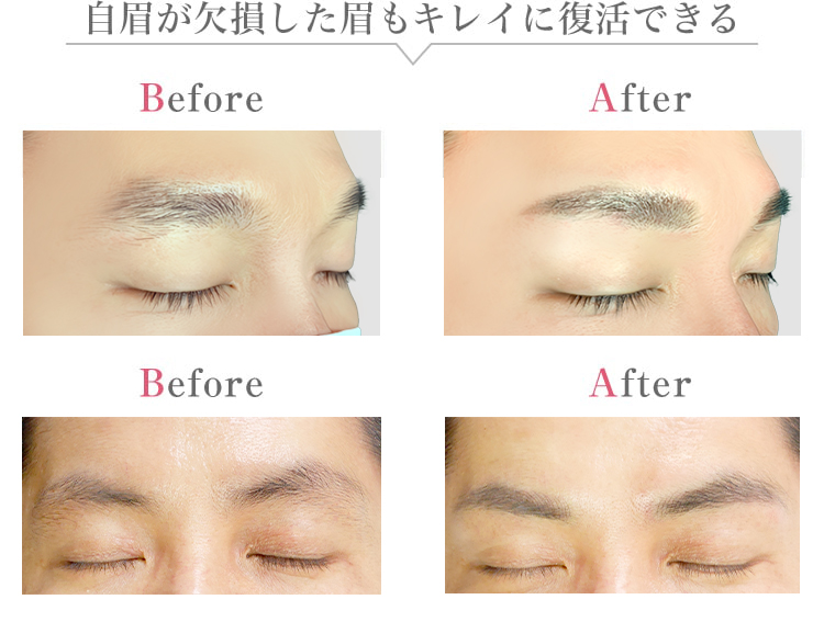 自眉が欠損した眉もキレイに復活できる