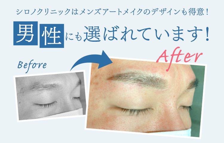 初診限定キャンペーン