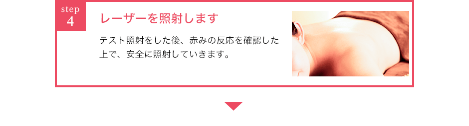 レーザーを照射します