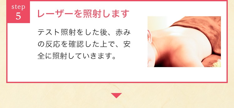 レーザーを照射します