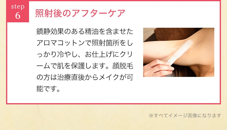 照射後のアフターケア※すべてイメージ画像になります