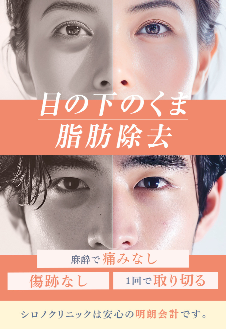開院30年美容皮膚科シロノクリニック｜目の下のたるみ・クマの原因　脂肪のふくらみを除去！