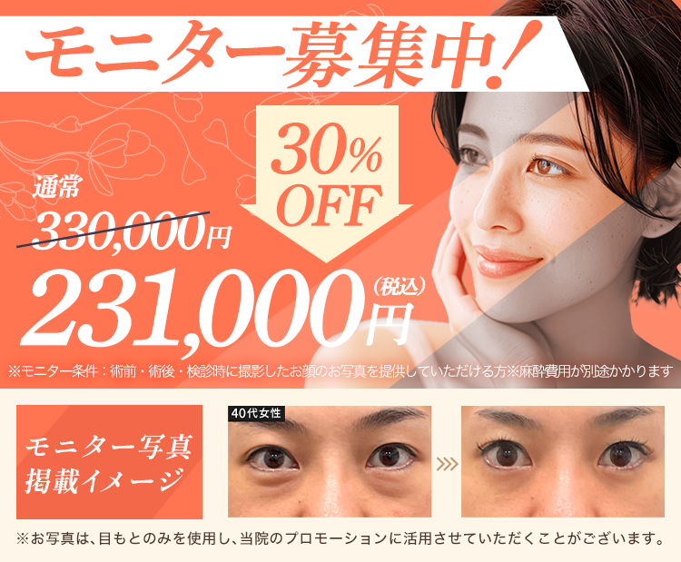 モニター募集中