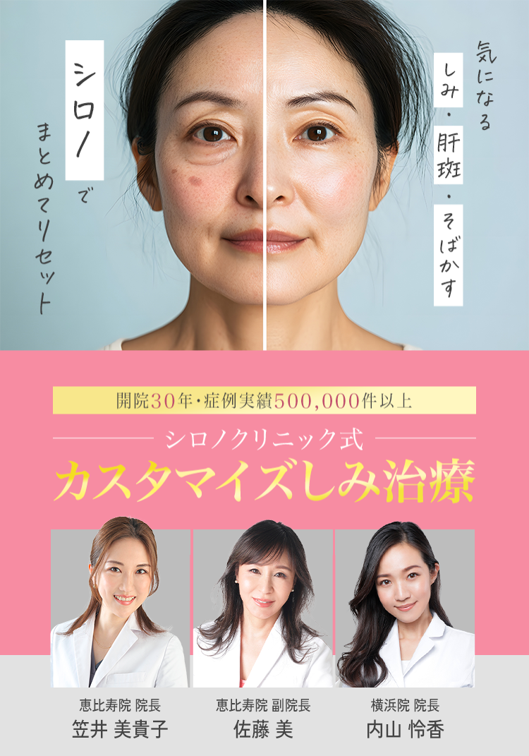 美容皮膚科シロノクリニック シミ治療 一人一人のシミに合わせた治療 諦めていたシミにも治療可能 厚生労働省認可だから安心・安全