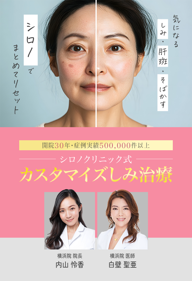 美容皮膚科シロノクリニック シミ治療 一人一人のシミに合わせた治療 諦めていたシミにも治療可能 厚生労働省認可だから安心・安全