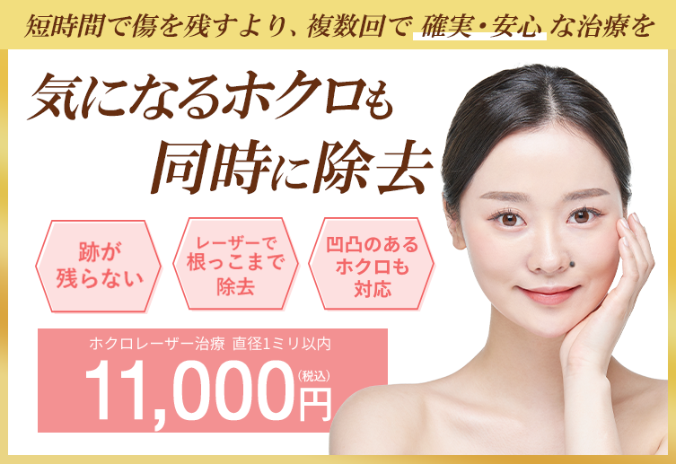 気になるホクロも同時に除去