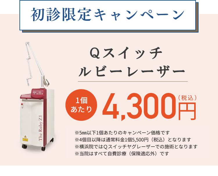1ヶ所から取る!Qスイッチ ルビーレーザー!1個あたり4,300円（税込）/ 広範囲から取る！フォトシルク プラス!頬～鼻まで39,600円（税込）