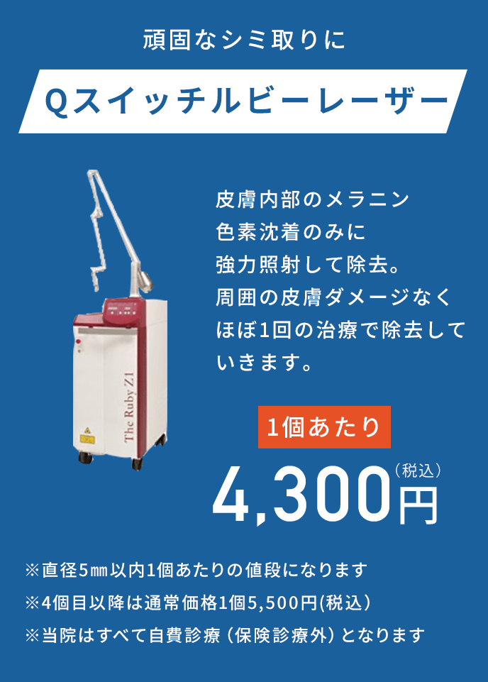 頑固なシミ取りにQスイッチルビーレーザー!皮膚内部のメラニン 色素沈着のみに 強力照射して除去。 周囲の皮膚ダメージなく ほぼ1回の治療で除去して いきます。1個あたり4,300円（税込） 