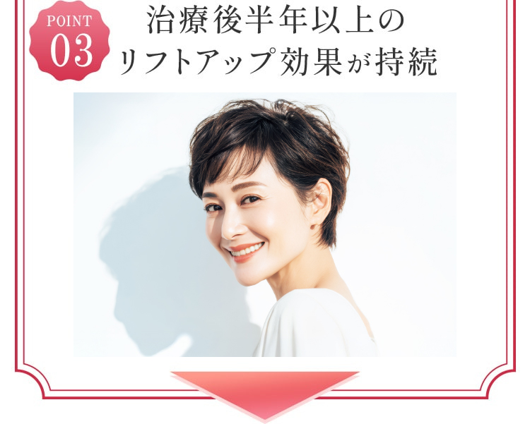 治療後半年以上のリフトアップ効果が持続