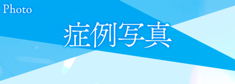 症例写真