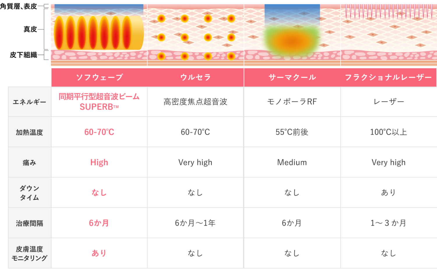 しわ・たるみ治療機器比較表（ソフウェーブ、ウルセラ、サーマクール、フラクショナルレーザー）