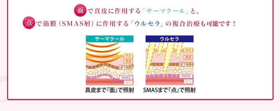 面と点の違い