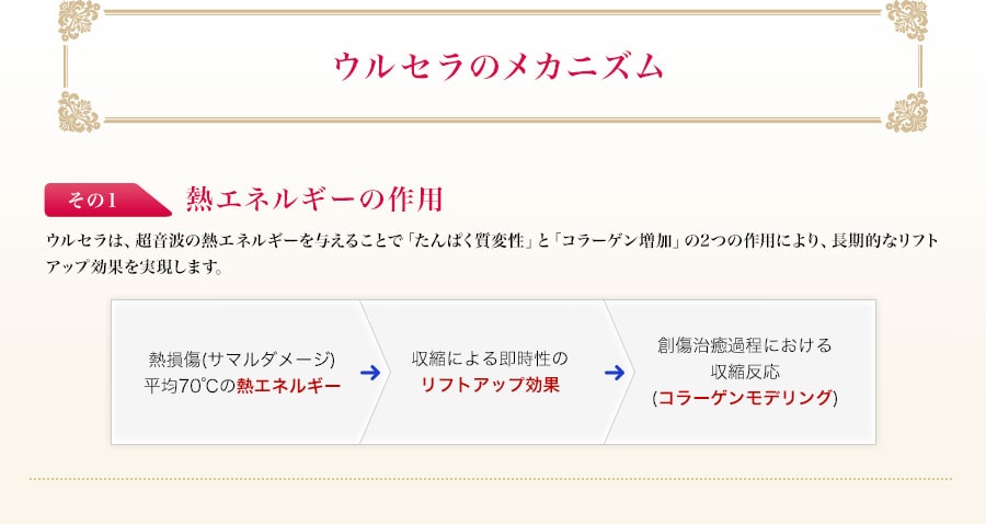 ウルセラのメカニズム