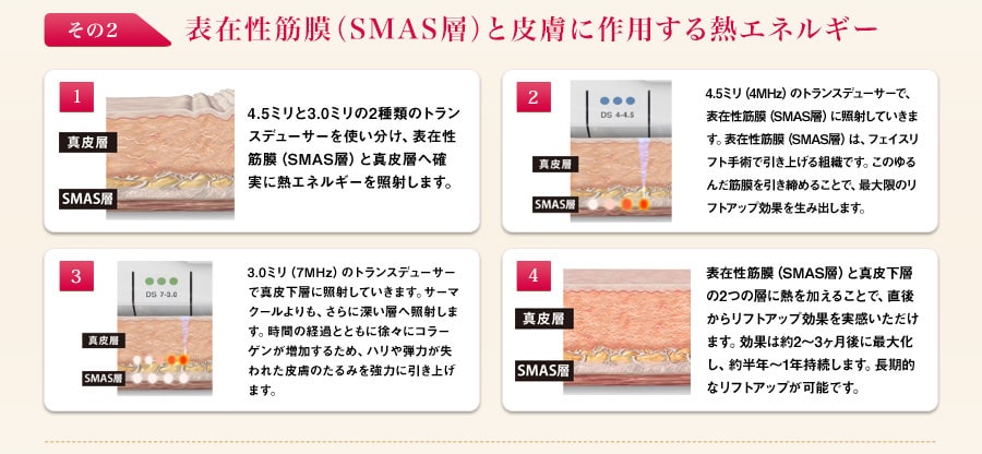 表在性筋膜と皮膚に作用する熱エネルギー