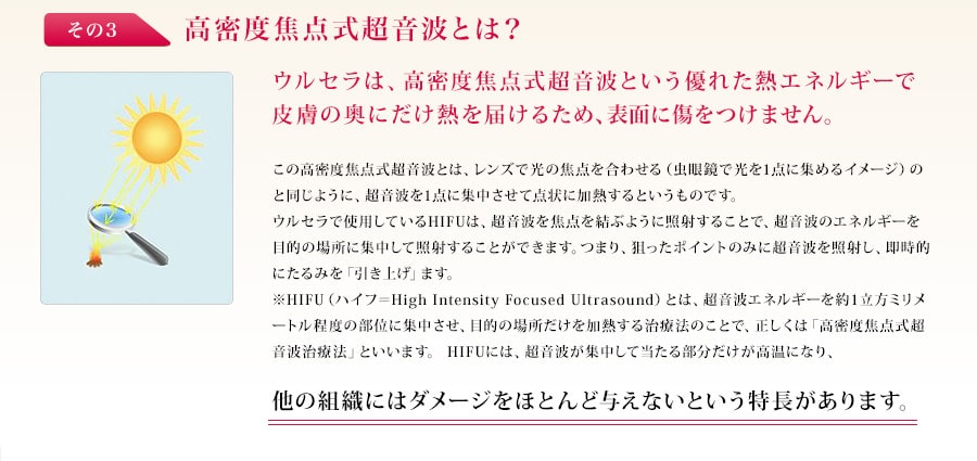 高密度焦点式超音波とは